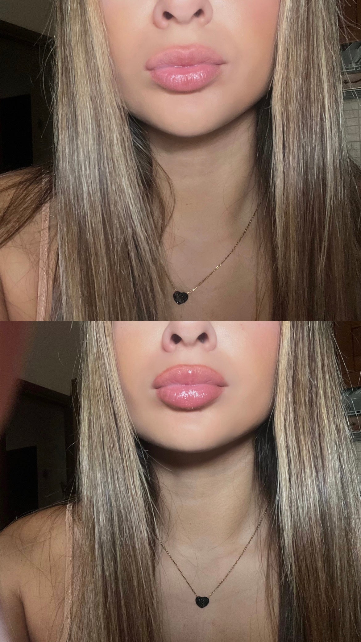 LipsBoom